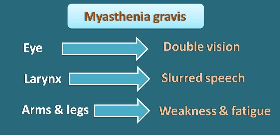 symptoms of myasthenia gravis